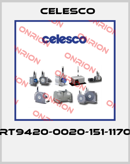 RT9420-0020-151-1170  Celesco